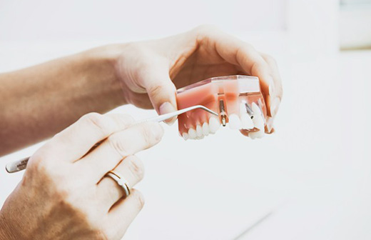 Протезирование и имплантация зубов