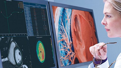 Эксперты в области лучевой диагностики признали медицинское программное обеспечение Philips лучшим в своей категории