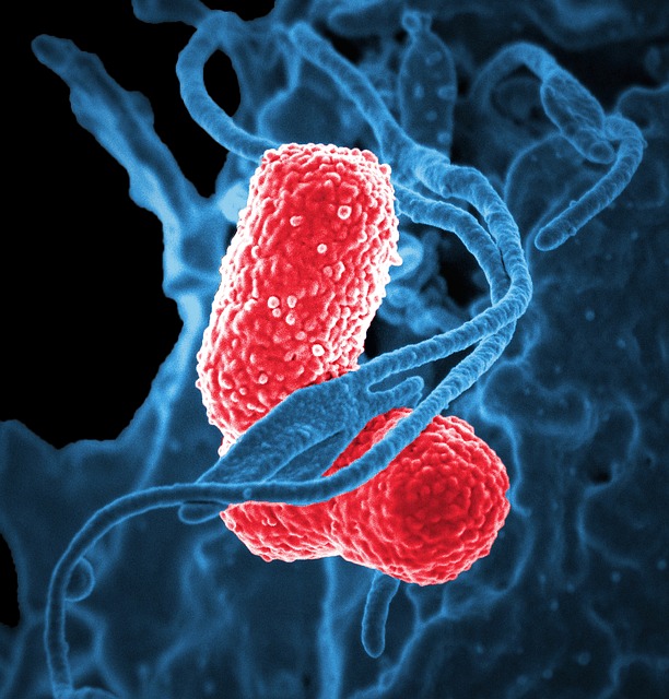 Klebsiella pneumoniae