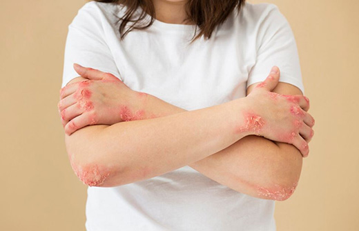 Дерматит у детей