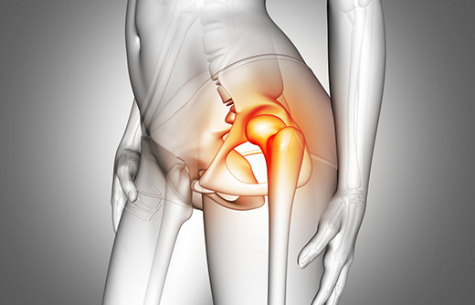 Эндопротезирование тазобедренного сустава