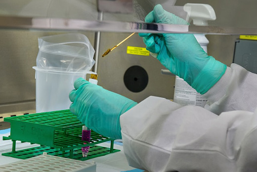 Токсоплазмоз