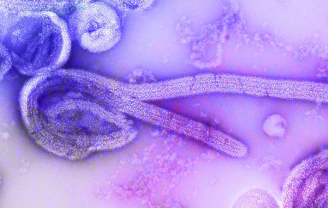 В США одобрен первый препарат для лечения вируса Эбола