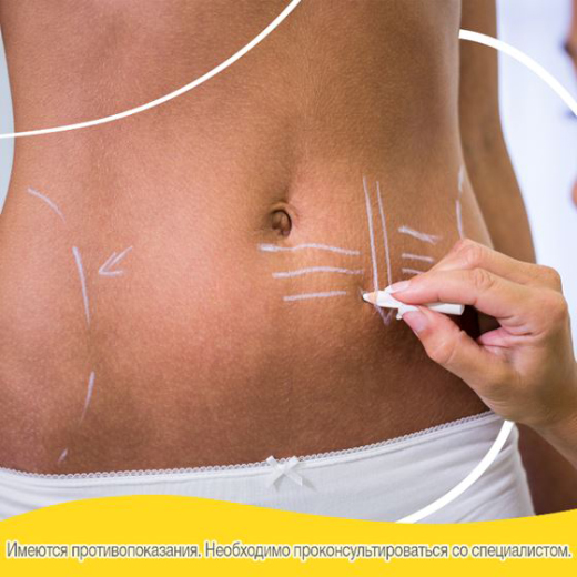 идеальные условия для заживления и минимизировать рубцы