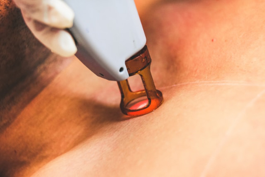 Лечение базалиомы