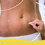 идеальные условия для заживления и минимизировать рубцы