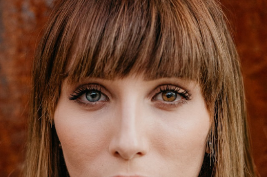 Гетерохромия