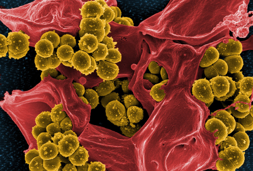 Бактерии MRSA под электронным микроскопом